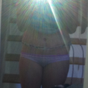 front view standing 2 days post op