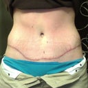 Don't mind the red stomach I got a little burned while tanning.