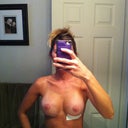 POST-OP 3 Weeks
