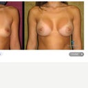 Result I'd like to get. Of course I'm darker skinned.