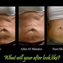 Stomach Before & After