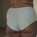 back view pre op