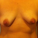 Before front