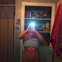Front view and my hips still look big and they're hard from the lipo and lumpy. I just hope they go down and the lumps go away.