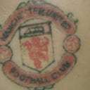 After 2nd treatment (coloured ink healed)