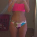 1 month post op