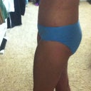3 months side view--still have some swelling