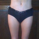 9 days post op & drains are out