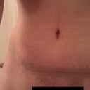 almost 4 weeks post op.  still very swollen but things looking good.