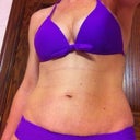 Front Pre-op