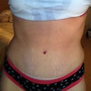 2 months PO front