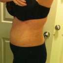 2 weeks post op