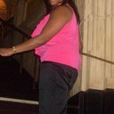 Before fat grafting to buttocks
