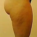 Before - right side
