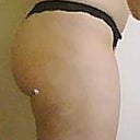 After - right side