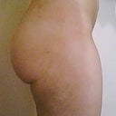 After - right side close up
