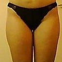 Front - before