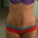 About 4-5 months post op:)
