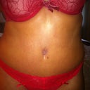 23 days post op. Still some swelling in my waist and hips but belly is flat!