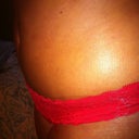 23 days post op side view