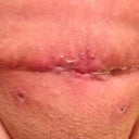 Yucky, but I am sure it will get better! 26 days PO