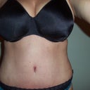 This was taken after my tt/but you can still get an idea of how out of proportion they are...