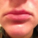 Mouth closed