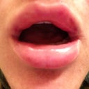 Mouth opened
