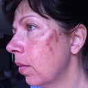 Burn marks or normal?