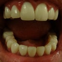 Study the lower set of teeth. The shapes don't vary.