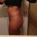 Seem a little swollen in the top of my stomach.