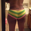 4 weeks post op. back rolls gone.