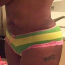 4 weeks post op