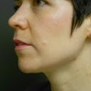 After (3/2012)