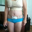 DAY 3 POSTOP- Stomach does look flat! Excited about that!
