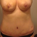after apt, strips off