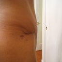 2 months PO
