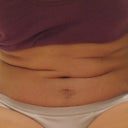 2months PO- so much extra folds when i sit down and hunch over..yuck!