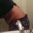 Bad lighting, but this is how much extra skin I have. :(
