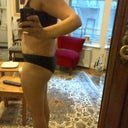 PO day 13- extended tummy tuck and thigh lipo- side view almost standing straight but still have bruising on the side you can see.