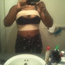 10 hours post-op. Hurts too much to unhook bra so I'll post those pics tomorrow