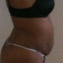 Before side view