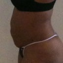Before side view