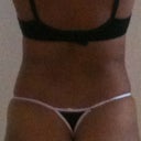 Before back view