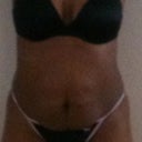 Before front view