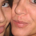 2011  A little over 6 years after surgery