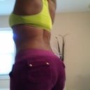 2 month Post Op BBL 18NOV12