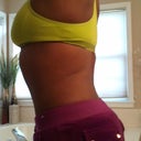2 month Post Op BBL 18NOV12