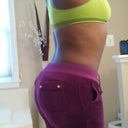 2 month Post Op BBL 18NOV12