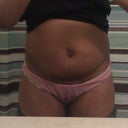 Before surgery